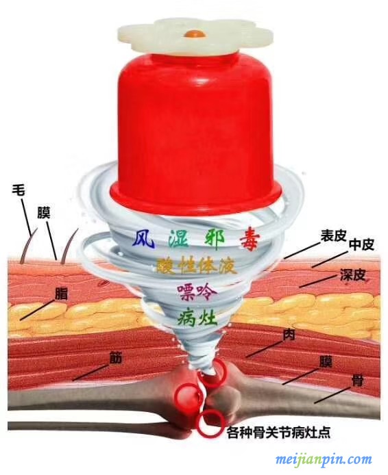 川坤拔罐組合套盒多少錢川坤拔罐原理