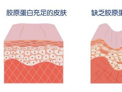胶原蛋白双蛋白肽饮品代加工OEM贴牌