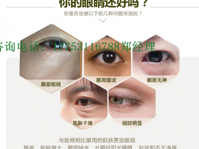 眼贴厂家批发润目 医用冷敷贴厂家OEM贴牌加工
