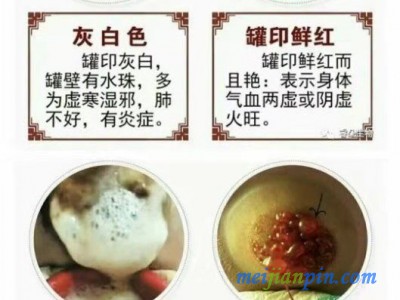 为什么拔川坤罐期间会感觉到晕