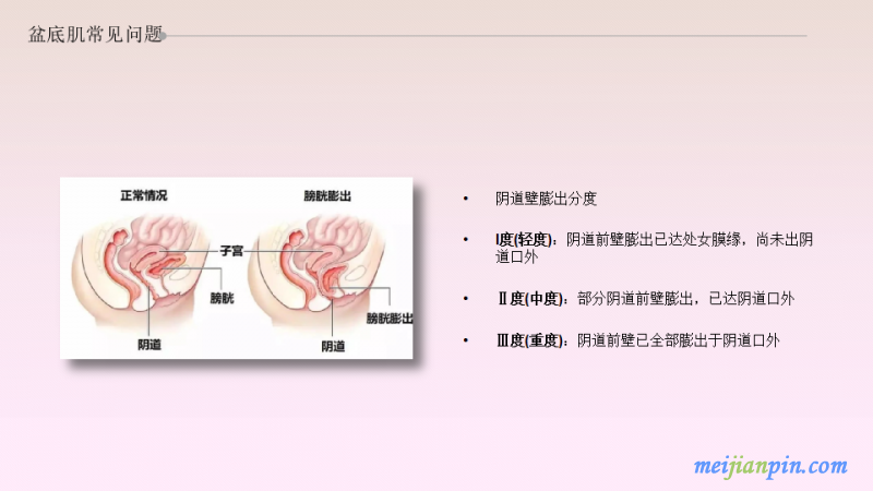 幻灯片7