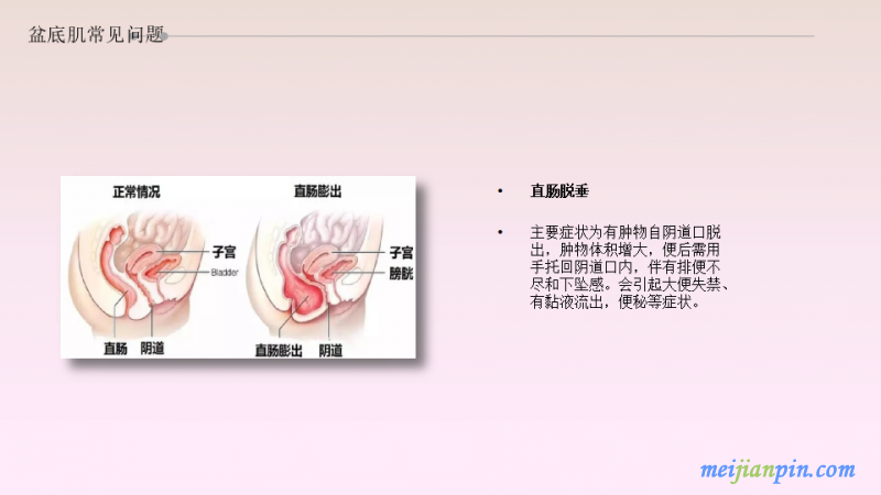 幻灯片9