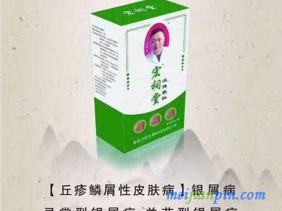 宏祠堂50ml液体敷料（银屑病，牛皮癣）