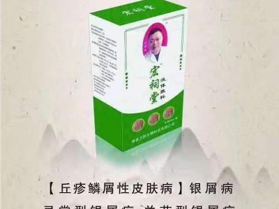 宏祠堂50ml液体敷料（银屑病，牛皮癣）