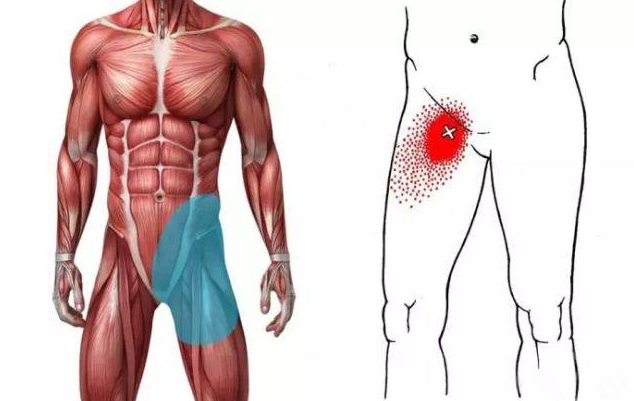 腹股沟疼痛的原因 六大病因导致腹股沟疼痛
