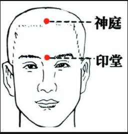 神庭穴位位置图 如何正确取神庭穴