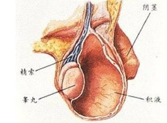 鞘膜积液的治疗方法 三大方法解决鞘膜积液
