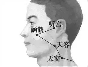 天容穴痛是怎么回事 天容穴痛的原因及治疗