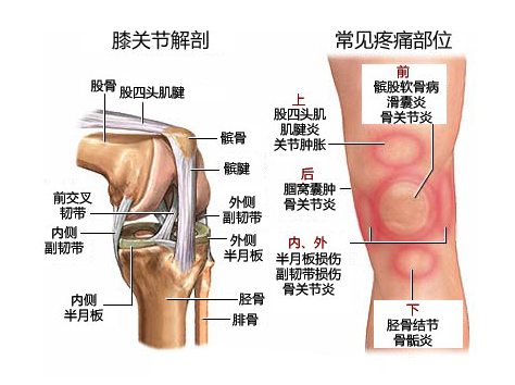 骨膜炎怎么样治疗 有效治疗骨膜炎的三种方法