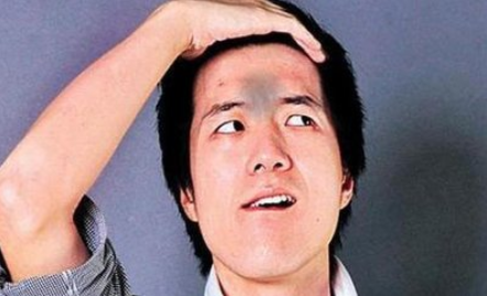 印堂发黑怎么办 两大方法帮你轻松摆脱印堂发黑