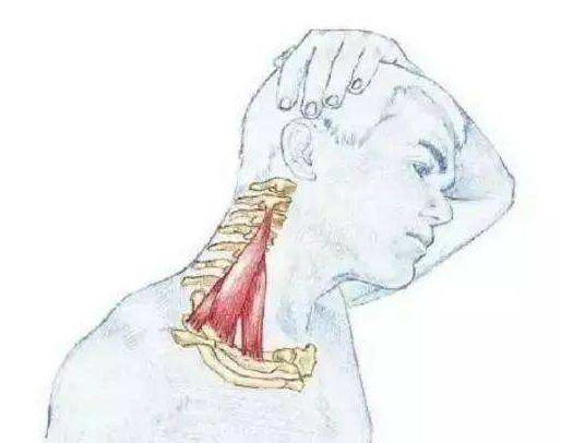 脖子落枕怎么办 四个方法让你缓解落枕的症状