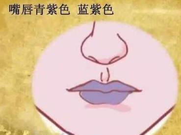 嘴唇发紫是什么原因 揭秘导致嘴唇发紫的因素