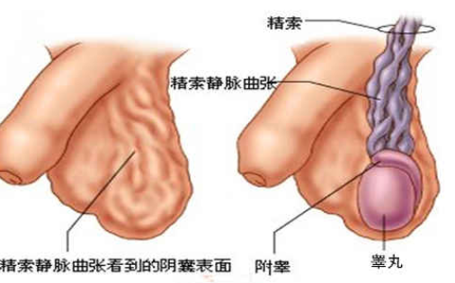 男人睾丸疼痛是怎么回事 警惕这3种病