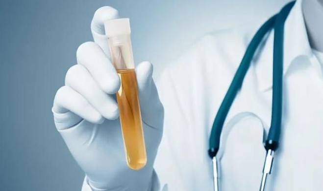 女性尿酸正常值是多少   分析三个时段尿酸正常值