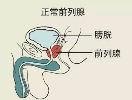 男人前列腺按摩的好处是什么 可帮助改善前列腺炎症