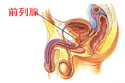 什么引起急性前列腺炎 导致急性前列腺炎的原因