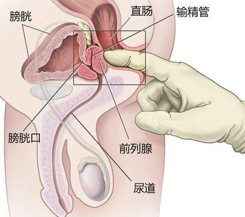 前列腺疼怎么缓解 六大方法缓解前列腺疼