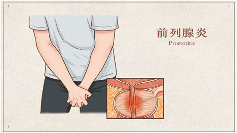 男性前列腺病变有什么征兆   身体的四个警报说明你病了