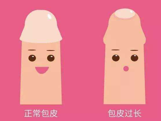 男生割包茎会变大吗 割包茎手术后怎么护理
