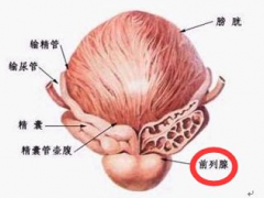前列腺炎吃什么药成效显著 用药原则是什么