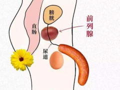 前列腺炎怎么治疗?前列腺炎食疗治疗