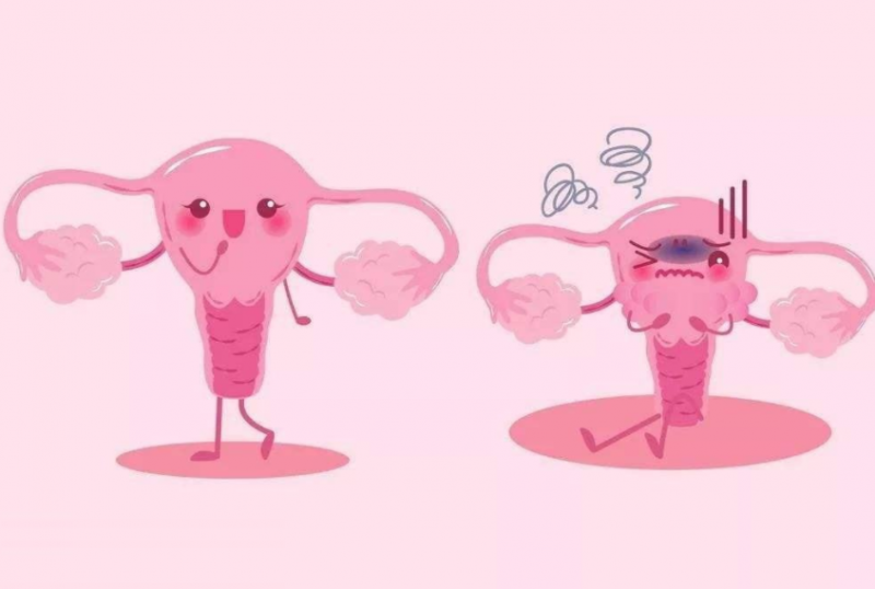 霉菌性阴炎是什么原因引起的