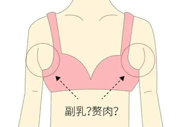 腋下副乳疼痛是什么原因 腋下副乳疼怎么消除