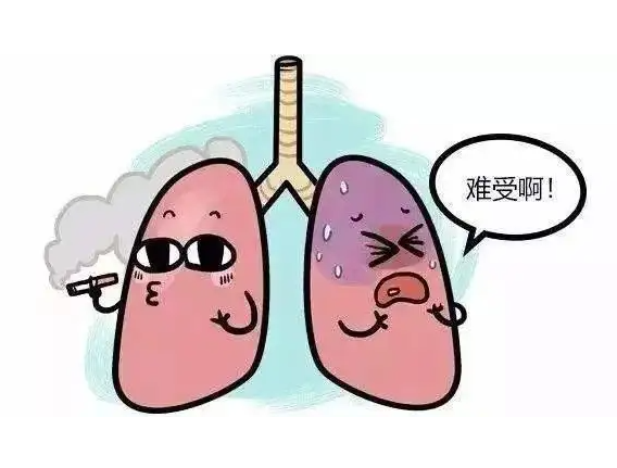 肺结核咳嗽6特点 怎样排除自己不是肺结核