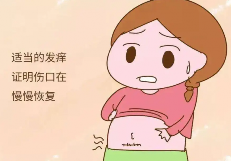 剖腹产伤疤真的好难看，别急，做好这5点让疤痕去无踪