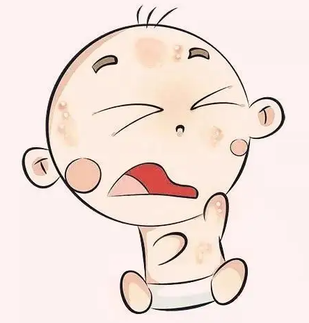 婴儿常见的14种皮肤病有哪些