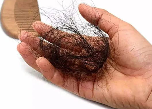 掉头发用什么洗发水