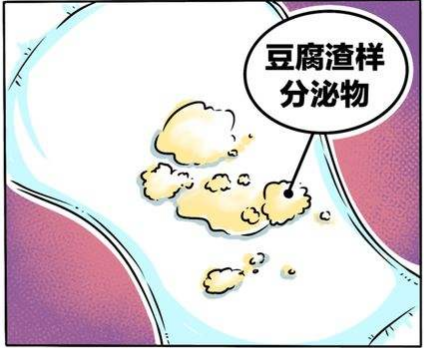 下面瘙痒还有豆腐渣一样的分泌物，外阴瘙痒白带豆腐渣如何用药