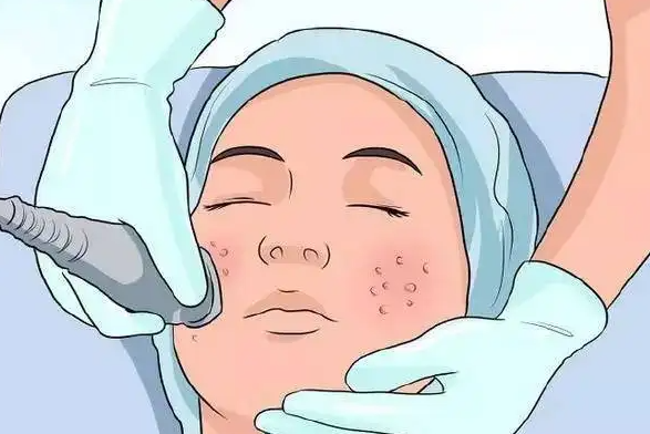 怎么除皱护肤 女人皱纹多怎么除皱