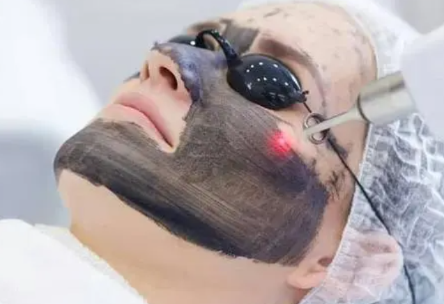 黑脸娃娃有什么效果？黑脸娃娃做一次价格