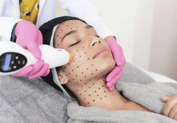 热玛吉怎么使用 热玛吉使用时注意事项