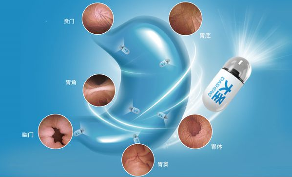 胃镜的作用 胃镜和肠镜能一起做吗