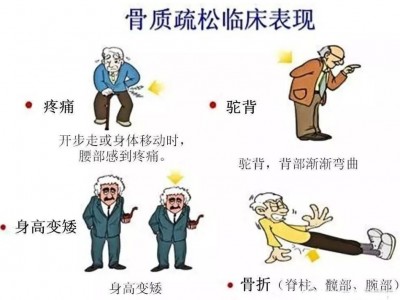 你知道骨质疏松症对你的生活有哪些影响吗？