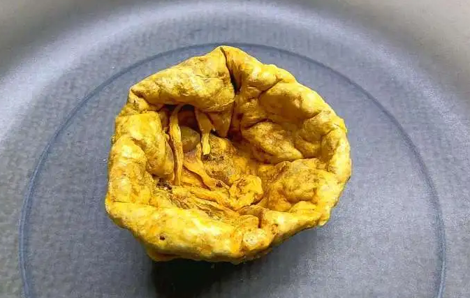 紫河车对男人的功效与作用 紫河车男人吃壮阳吗
