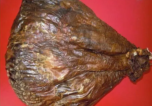 鹿胎盘的功效 鹿胎盘的禁忌