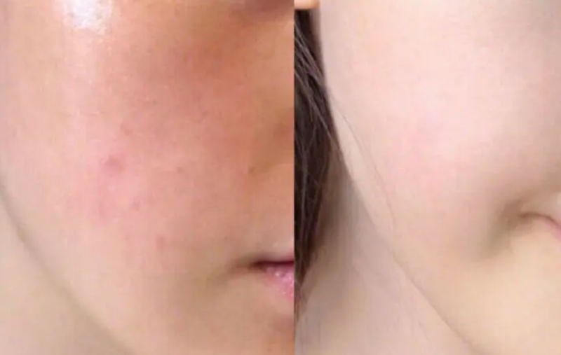 护肤问题女生哪个部位最需要注意保养？
