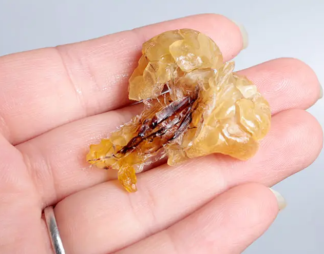 男人吃蛤蟆油补精子吗（男人精子活力增强药）