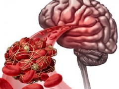 快速降血脂的方法 四种降脂方法分享