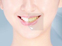 黄牙怎么变白的简单法 详解让牙齿变白的四种方法