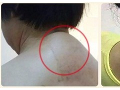 富贵包是什么 富贵包清除的方法