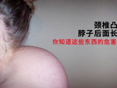富贵包有什么危害 详解富贵包的三个危害