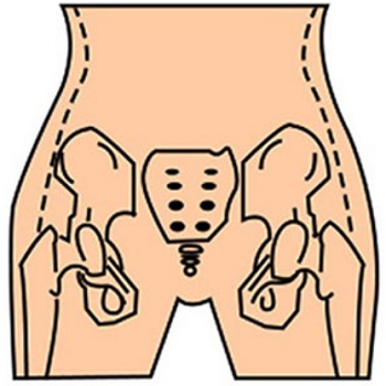 image 骨盆肌肉训练