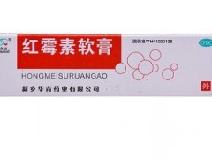外阴瘙痒用什么药效果最好 四种药止痒效果见效快