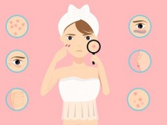 女人长斑的位置图解 这四个部位最容易长斑