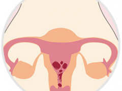 女人宫寒的症状有哪些表现 介绍宫寒的3个常见表现