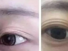肾不好的人有什么表现 人肾不好身体有什么反应